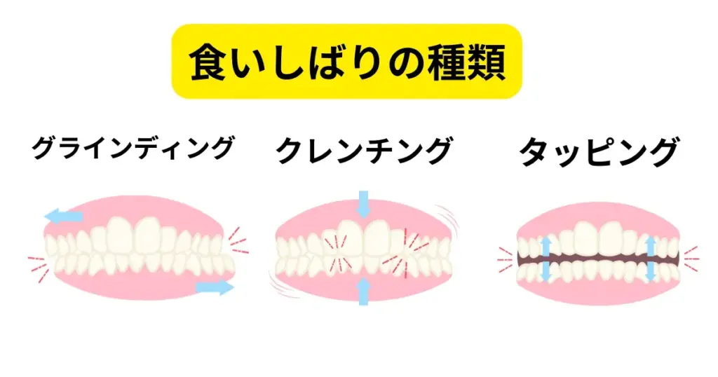 食いしばりの種類